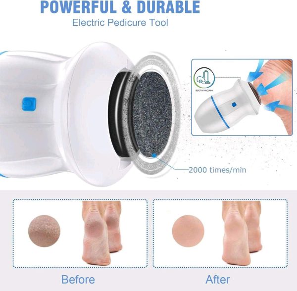 Electric Foot Grinder | Callus Remover